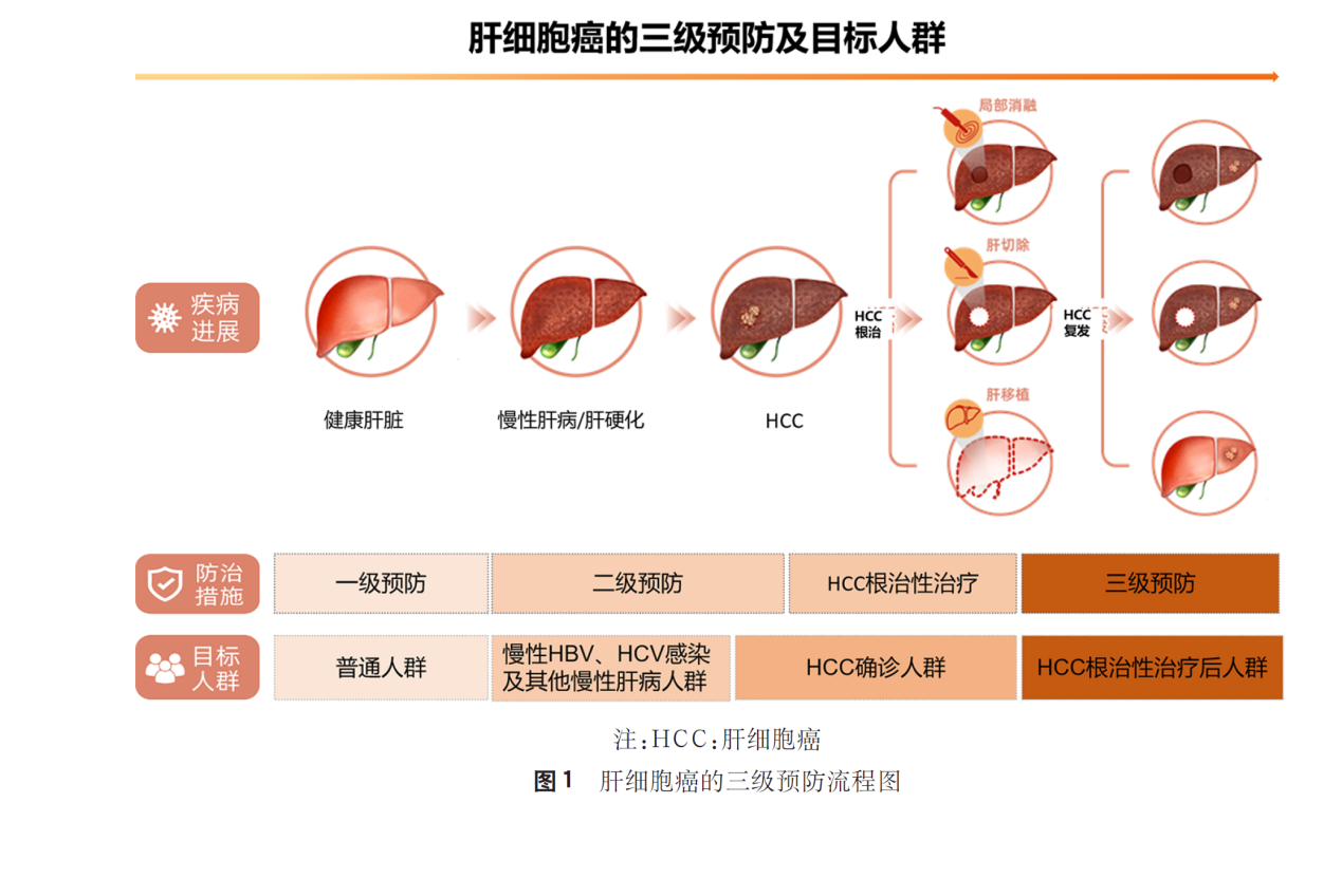 原發(fā)性肝癌三級預(yù)防共識（2022年版）指出復(fù)方鱉甲軟肝片有助于降低肝癌復(fù)發(fā)風(fēng)險(xiǎn)