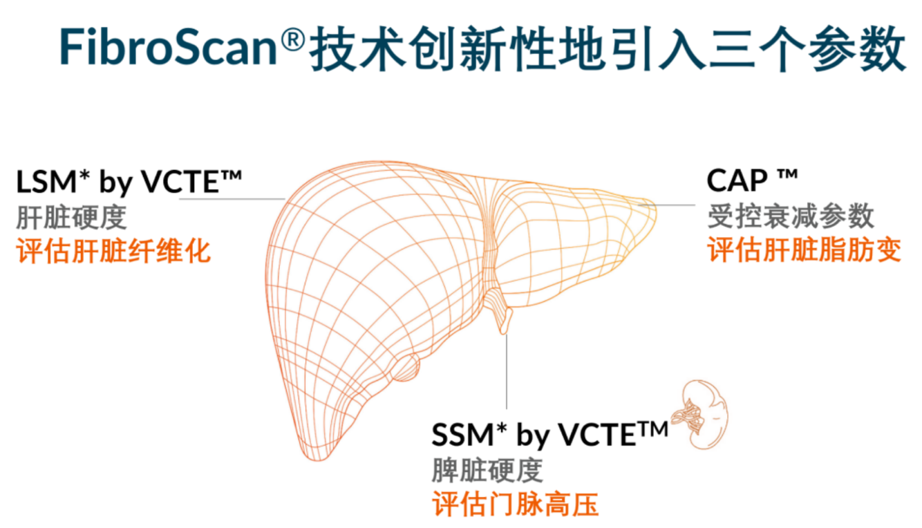 喜訊！FDA擴大了FibroScan?在肝臟綜合管理中的應用范圍