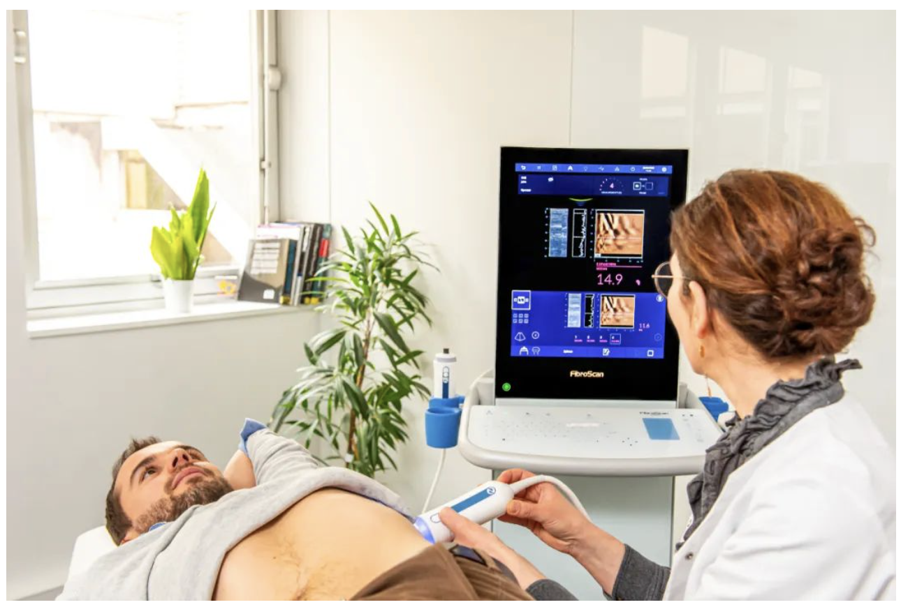 愛(ài)科森?學(xué)院專(zhuān)欄 | FibroScan?全球指南與共識(shí)推薦介紹（門(mén)靜脈高壓篇）